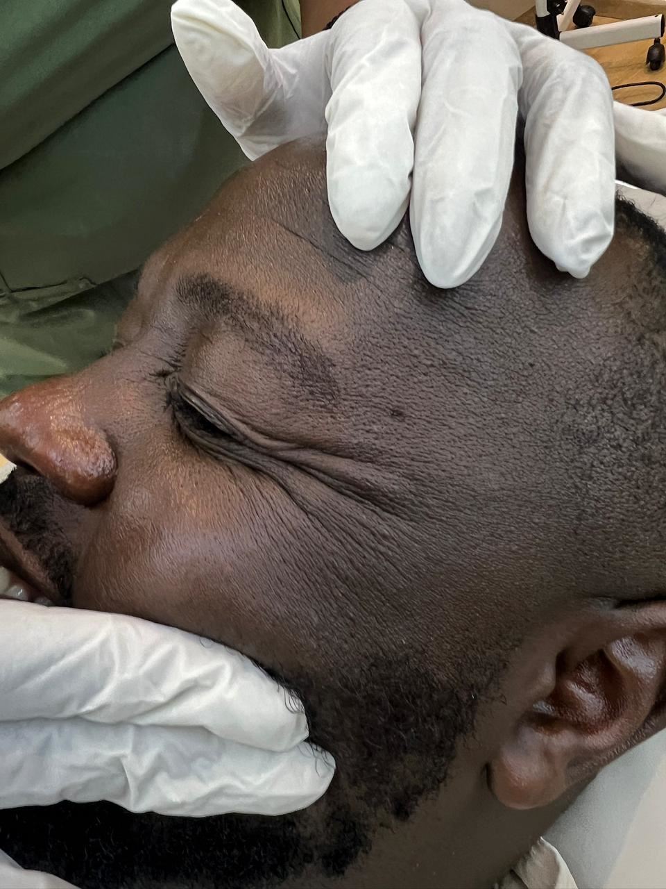 Skin examination during a dermatology consultation