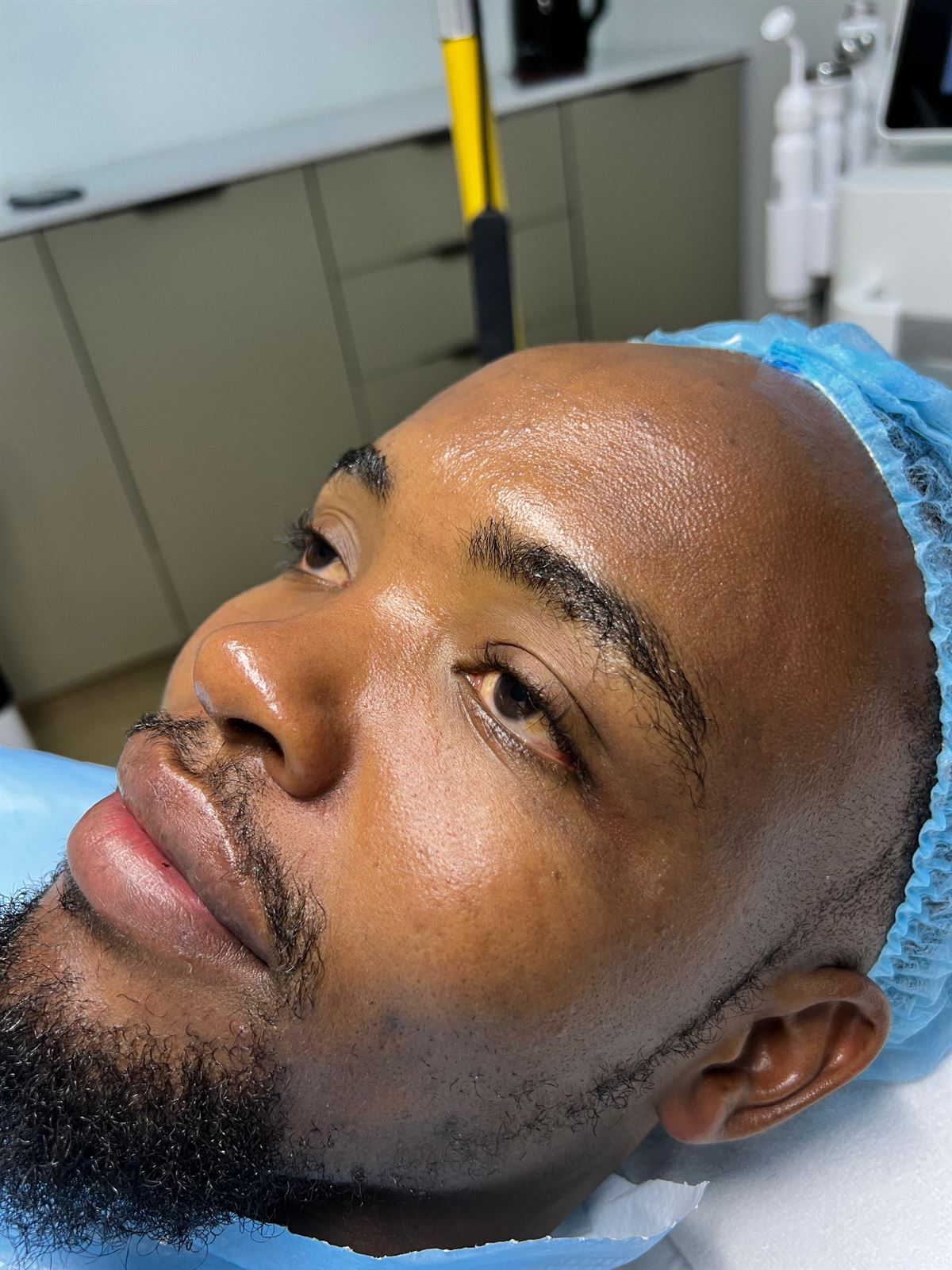 Clear, healthy skin after treatment at Petals Dermatology
